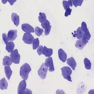 영구프레파라트-입안상피세포